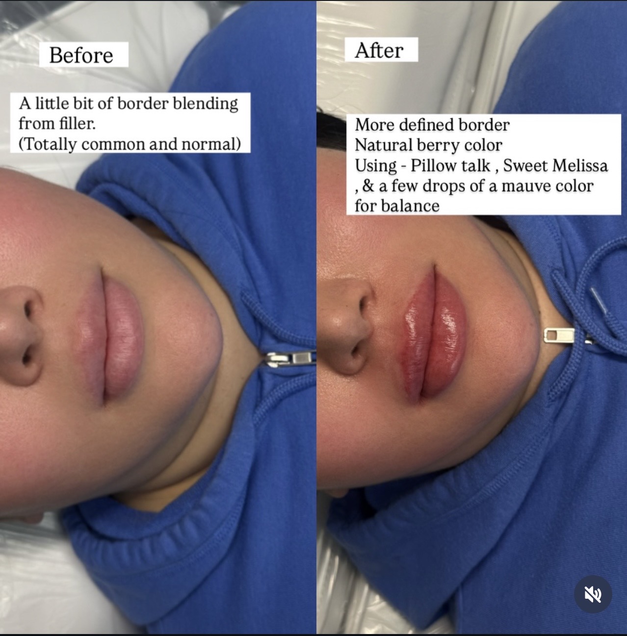 Lip Blush Berry Before After