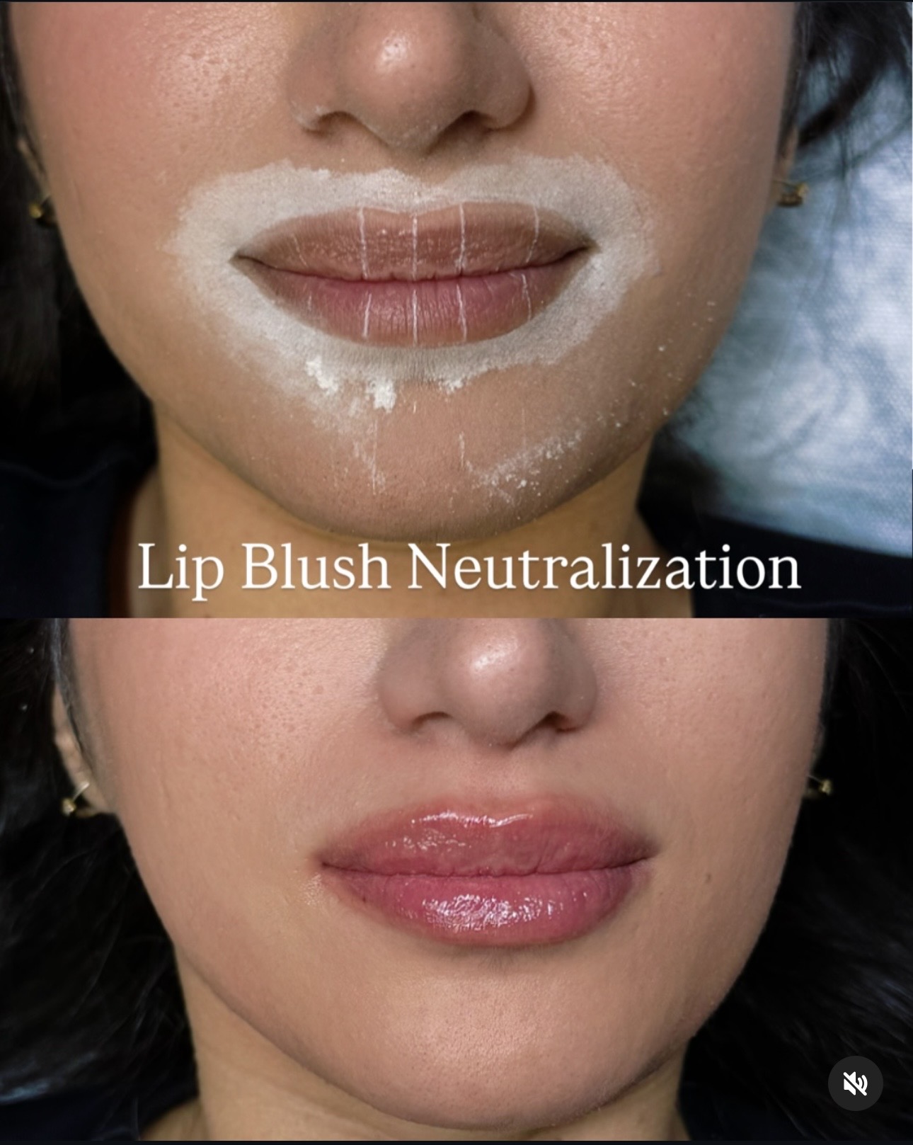 Lip Blush Neutralization