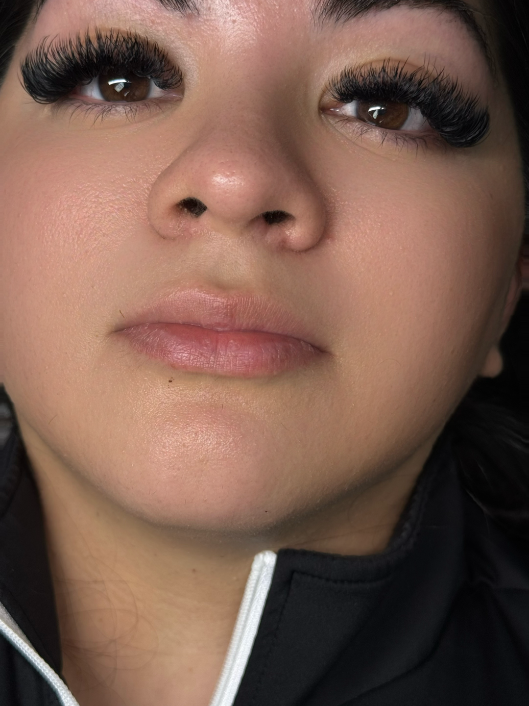 Natural Lips Before